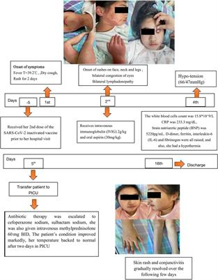 Case Report: A case of multisystem inflammatory syndrome in an 11-year-old female after COVID-19 inactivated vaccine